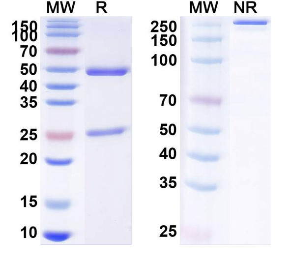 Anti-Human ENO2/NSE Monoclonal Antibody (1A303) - SDS-PAGE