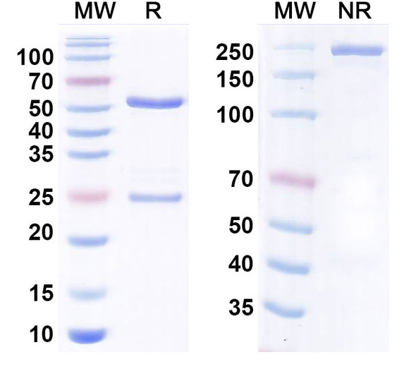 Anti-Human TG/Thyroglobulin Monoclonal Antibody (1A305) - SDS-PAGE