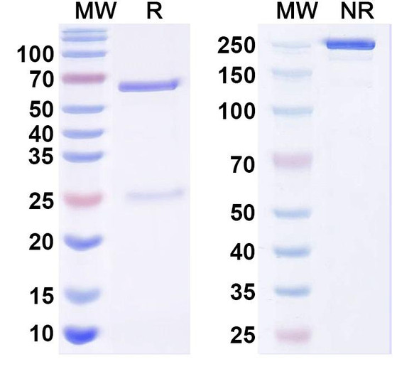 Anti-Human TG/Thyroglobulin Monoclonal Antibody (1A306) - SDS-PAGE