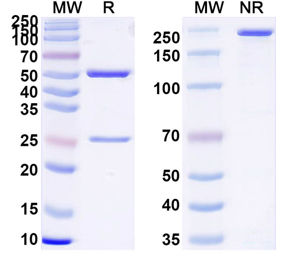 Anti-Human HB/Hemoglobin Monoclonal Antibody (1A312) - SDS-PAGE