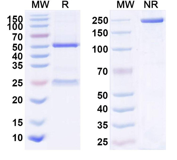 Anti-Human HB/Hemoglobin Monoclonal Antibody (1A313) - SDS-PAGE