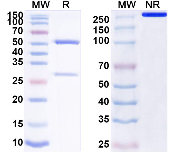Anti-Human Calprotectin (S100A8/S100A9) Monoclonal Antibody (1A316) - SDS-PAGE