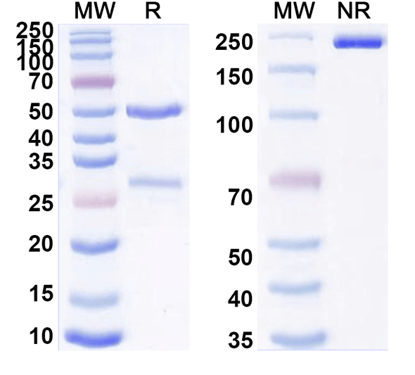 Anti-Human SAA Monoclonal Antibody (1A321) - SDS-PAGE