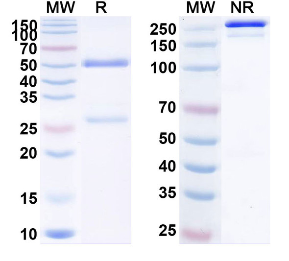 Anti-Human SAA Monoclonal Antibody (1A323) - SDS-PAGE