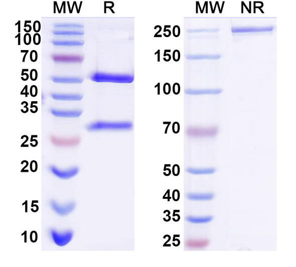 Anti-Human AZU1/CAP37/HBP Monoclonal Antibody (1A330) - SDS-PAGE