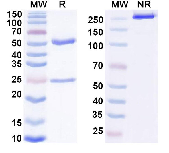 Anti-Human PCT/Procalcitonin Monoclonal Antibody (1A334) - SDS-PAGE