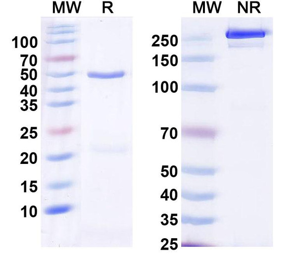 Anti-Human PCT/Procalcitonin Monoclonal Antibody (1A335) - SDS-PAGE