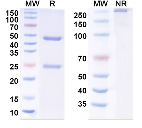 Anti-Human MYO Monoclonal Antibody (1A337) - SDS-PAGE