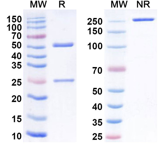 Anti-Human FABP3/HFABP Monoclonal Antibody (1A343) - SDS-PAGE