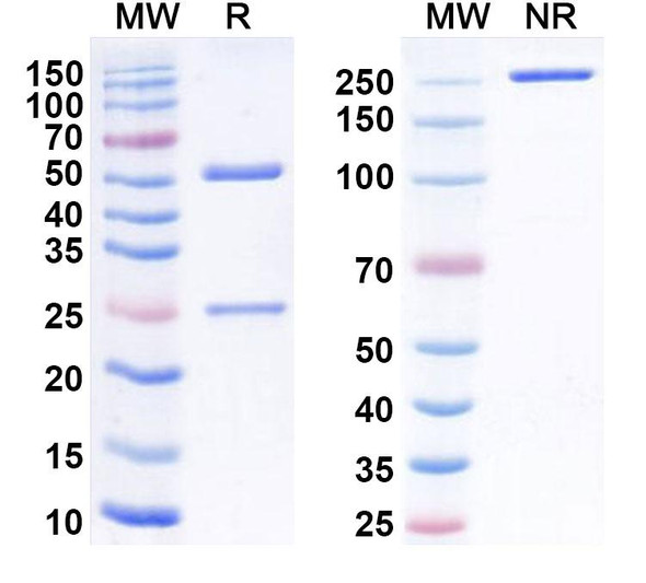 Anti-Human FABP3/HFABP Monoclonal Antibody (1A343) - SDS-PAGE