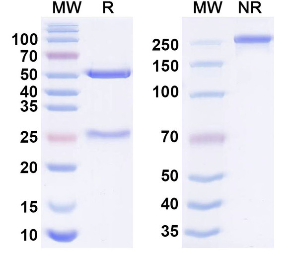 Anti-Human IL1RL1/ST2 Monoclonal Antibody (1A359) - SDS-PAGE