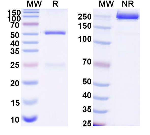 Anti-Human SHBG Monoclonal Antibody (1A381) - SDS-PAGE