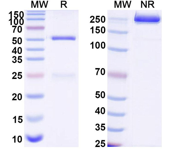 Anti-Human SHBG Monoclonal Antibody (1A381) - SDS-PAGE