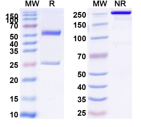 Anti-Human SHBG Monoclonal Antibody (1A383) - SDS-PAGE