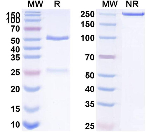 Anti-Human CST3/Cys C Monoclonal Antibody (1A385) - SDS-PAGE