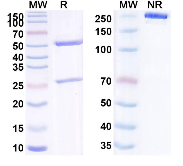 Anti-Human LCN2/NGAL Monoclonal Antibody (1A392) - SDS-PAGE