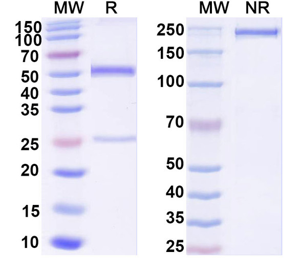 Anti-Human Adiponectin/ADPN Monoclonal Antibody (1A401) - SDS-PAGE