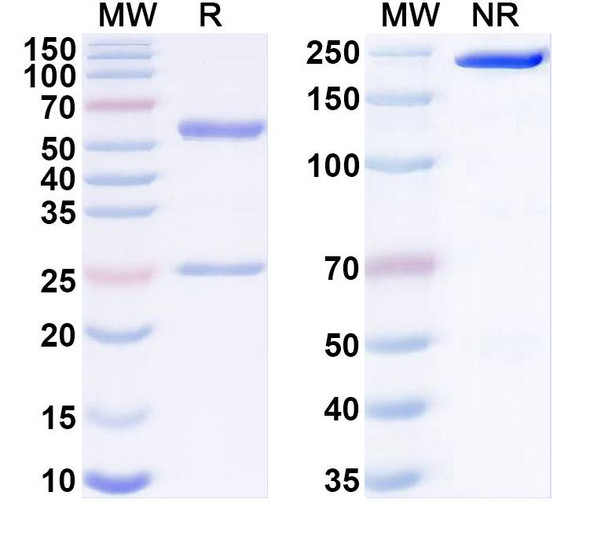 Anti-Human PAPPA Monoclonal Antibody (1A406) - SDS-PAGE
