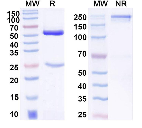 Anti-Human PAPPA Monoclonal Antibody (1A407) - SDS-PAGE