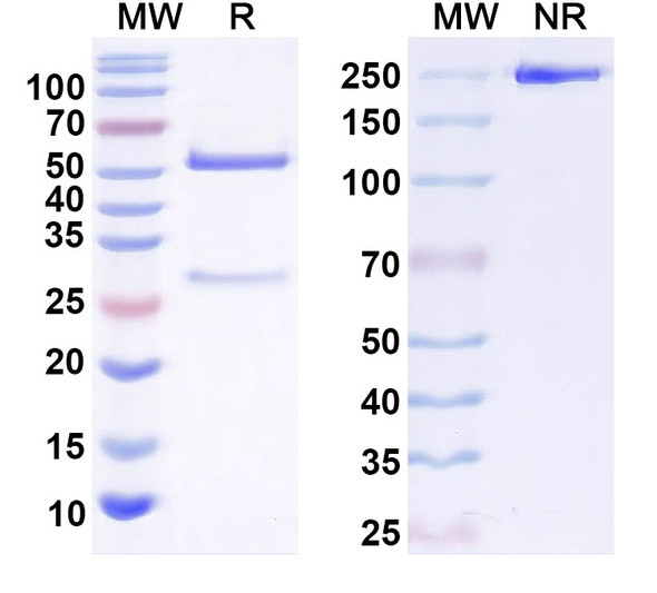 Anti-Human SP10/ACRV1 Monoclonal Antibody (1A408) - SDS-PAGE