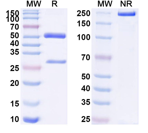 Anti-Human SP10/ACRV1 Monoclonal Antibody (1A409) - SDS-PAGE
