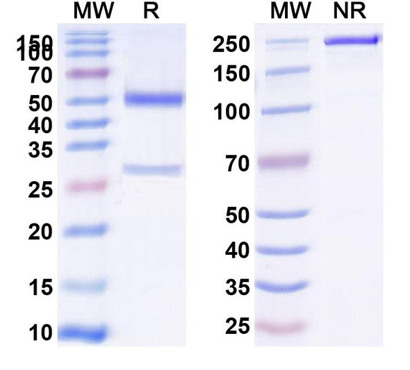 Anti-Human SP10/ACRV1 Monoclonal Antibody (1A411) - SDS-PAGE