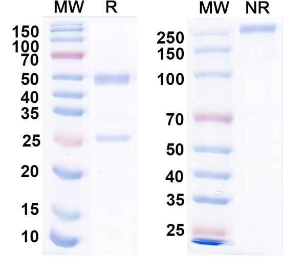 Anti-Human FLT1/VEGFR1 Monoclonal Antibody (1A419) - SDS-PAGE