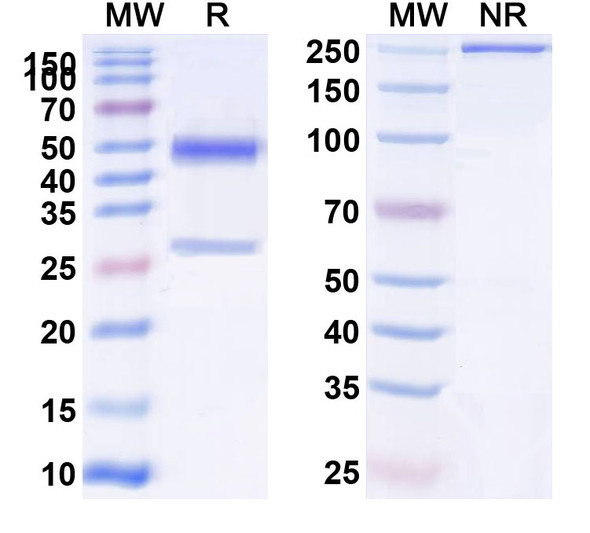 Anti-Human RAB39B Monoclonal Antibody (1A443) - SDS-PAGE