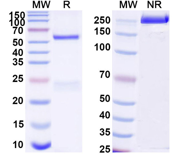 Anti-Human RAB39B Monoclonal Antibody (1A444) - SDS-PAGE