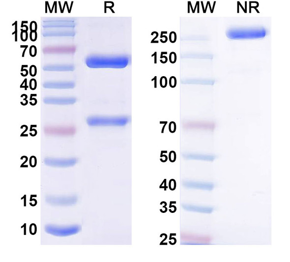 Anti-BETVII/Allergen Bet v II Monoclonal Antibody (1A448) - SDS-PAGE