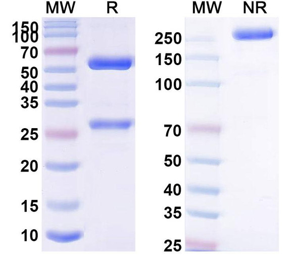 Anti-BETVII/Allergen Bet v II Monoclonal Antibody (1A448) - SDS-PAGE