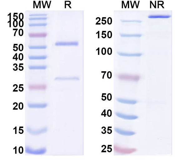 Anti-Human CD61/ITGB3 Monoclonal Antibody (1A469) - SDS-PAGE