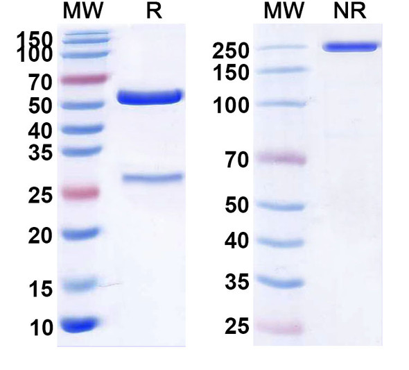 Anti-Human CD61/ITGB3 Monoclonal Antibody (1A470) - SDS-PAGE