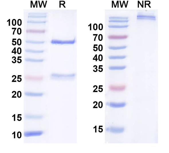 Anti-Human CD56/NCAM1 Monoclonal Antibody (1A485) - SDS-PAGE