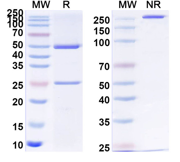 Anti-Human CD56/NCAM1 Monoclonal Antibody (1A486) - SDS-PAGE