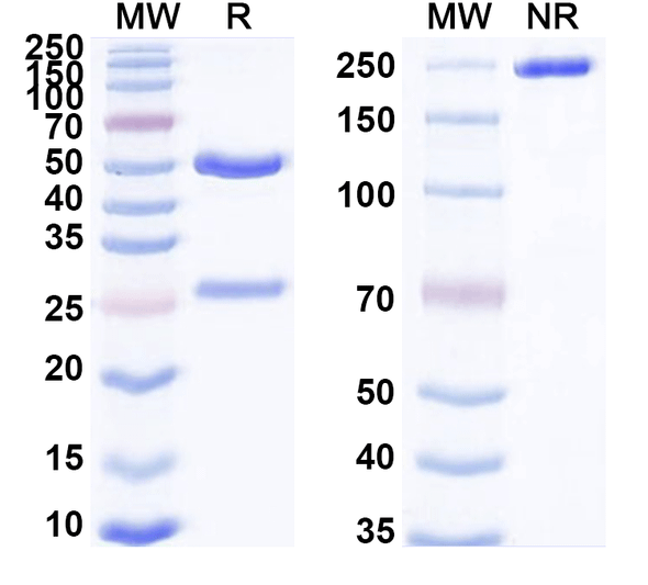 Anti-Human UPK3A Monoclonal Antibody (1A494) - SDS-PAGE