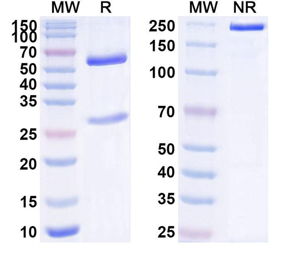 Anti-Human UPK3A Monoclonal Antibody (1A495) - SDS-PAGE