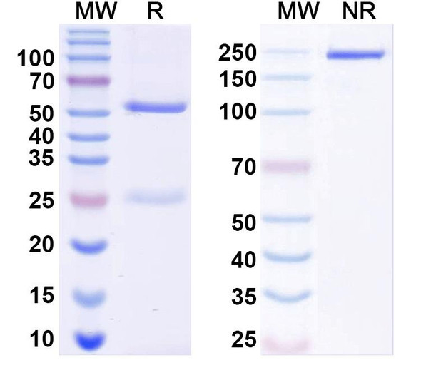 Anti-Human CAV1 Monoclonal Antibody (1A515) - SDS-PAGE