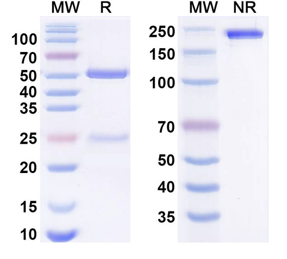 Anti-Human IRF4 Monoclonal Antibody (1A516) - SDS-PAGE
