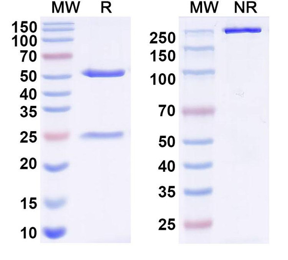 Anti-Human KRT7 Monoclonal Antibody (1A520) - SDS-PAGE