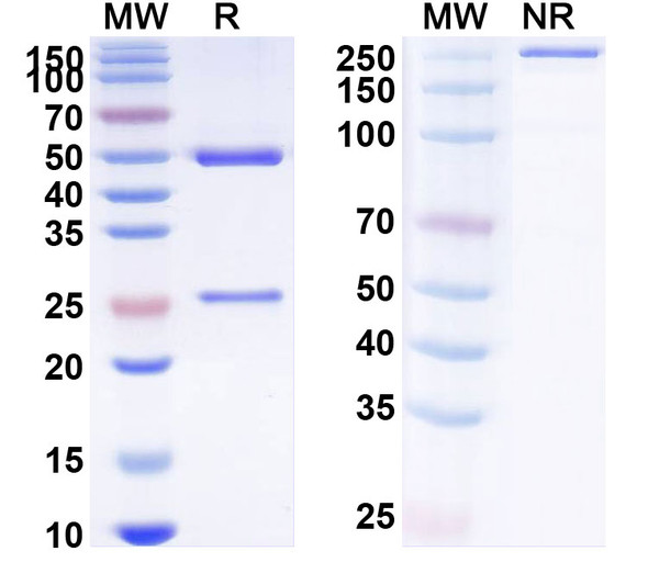 Anti-Human KRT5 Monoclonal Antibody (1A528) - SDS-PAGE