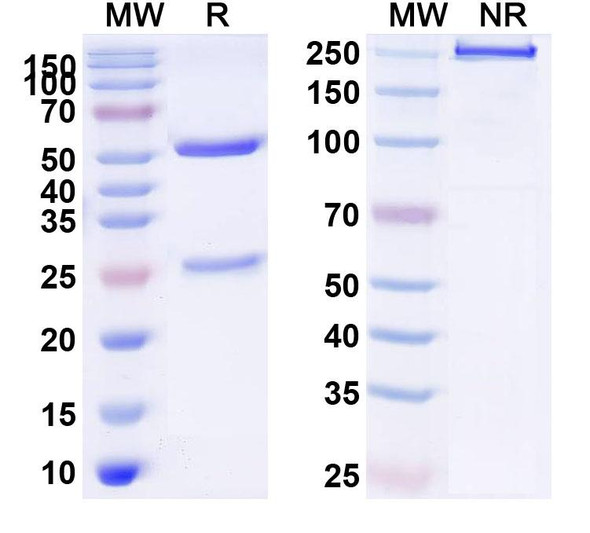 Anti-Human PSEN2 Monoclonal Antibody (1A531) - SDS-PAGE
