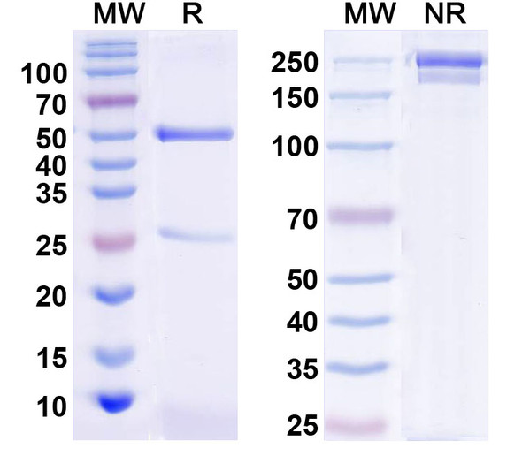 Anti-Human S100A10 Monoclonal Antibody (1A534) - SDS-PAGE