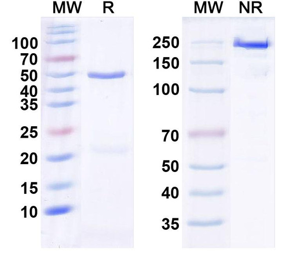 Anti-Human DCX Monoclonal Antibody (1A537) - SDS-PAGE