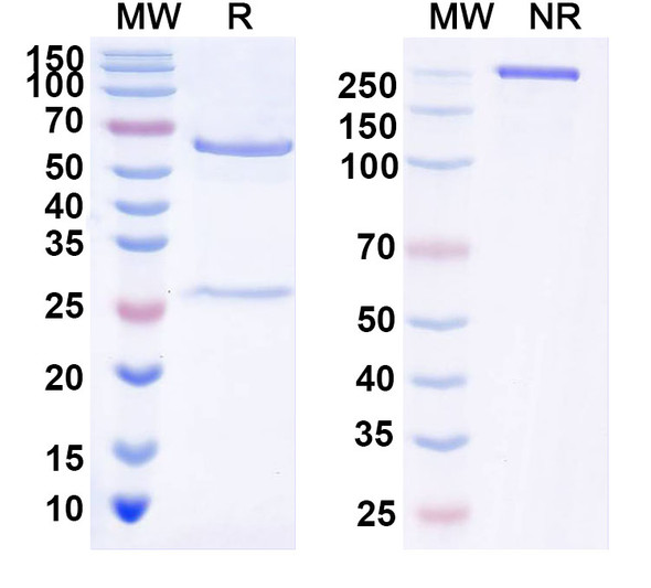 Anti-Human DCX Monoclonal Antibody (1A539) - SDS-PAGE