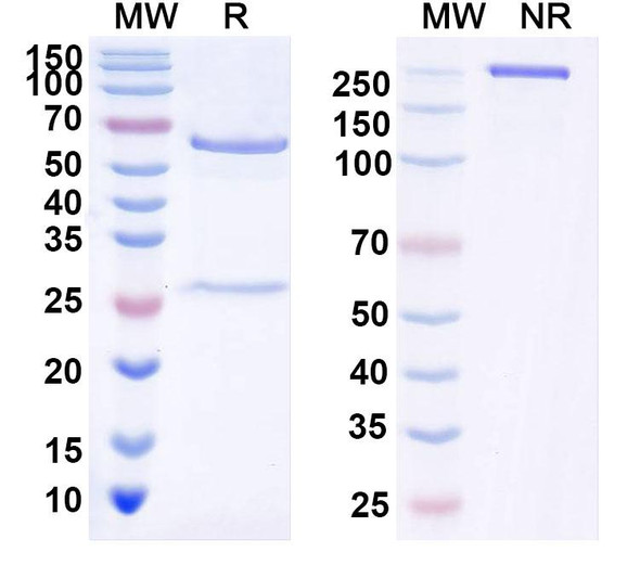 Anti-Human DCX Monoclonal Antibody (1A539) - SDS-PAGE