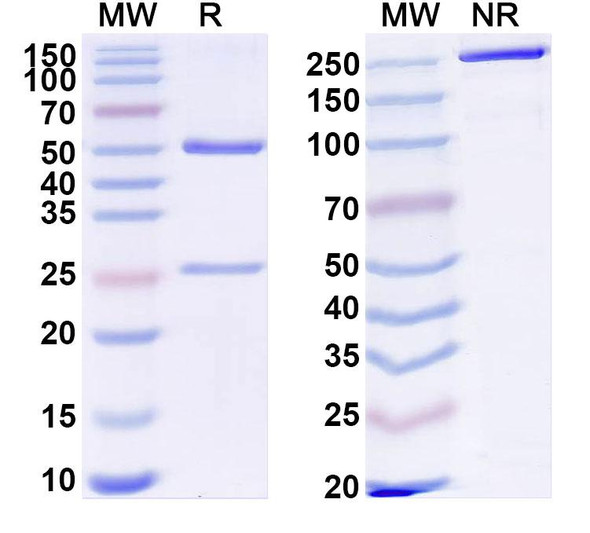 Anti-Human SFTPB Monoclonal Antibody (1A556) - SDS-PAGE