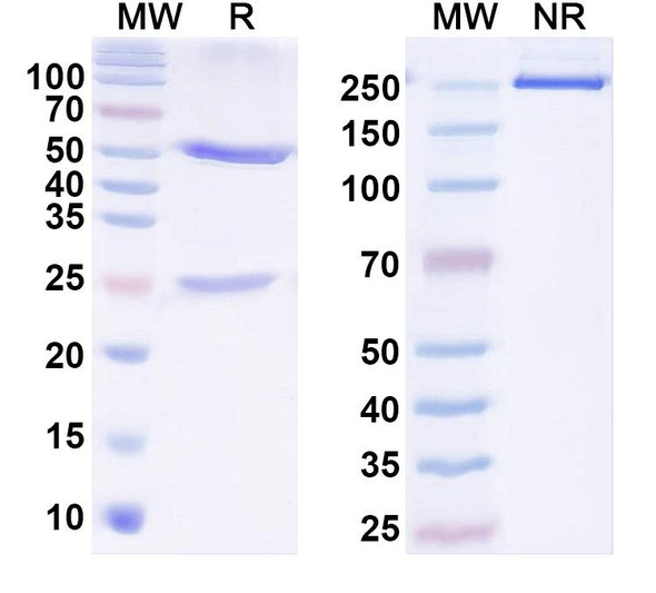 Anti-Human MAP2 Monoclonal Antibody (1A559) - SDS-PAGE