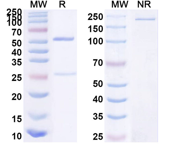 Anti-Human CD123/IL3RA Monoclonal Antibody (1A566) - SDS-PAGE