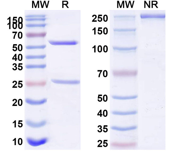 Anti-Human MUC6 Monoclonal Antibody (1A593) - SDS-PAGE